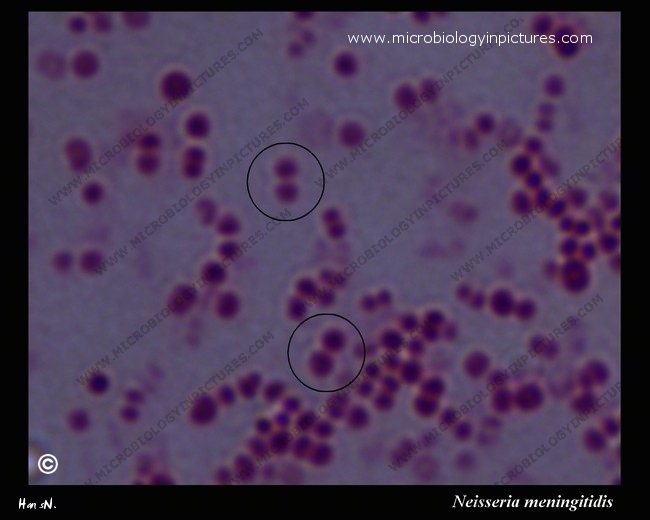 neisseria meningitidis bacteria en fitness health meningitidis neisseria meningitidis