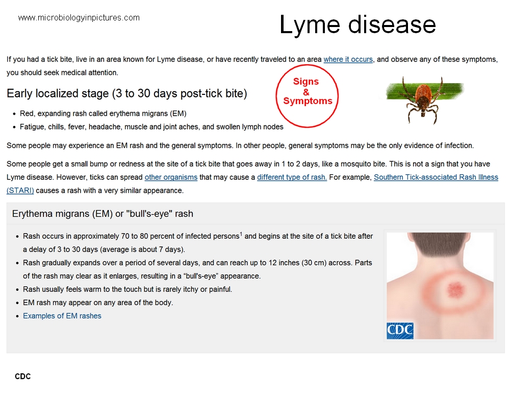 Dating Lyme Disease