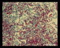 acid-fast and non-acid-fast bacilli, micrograph