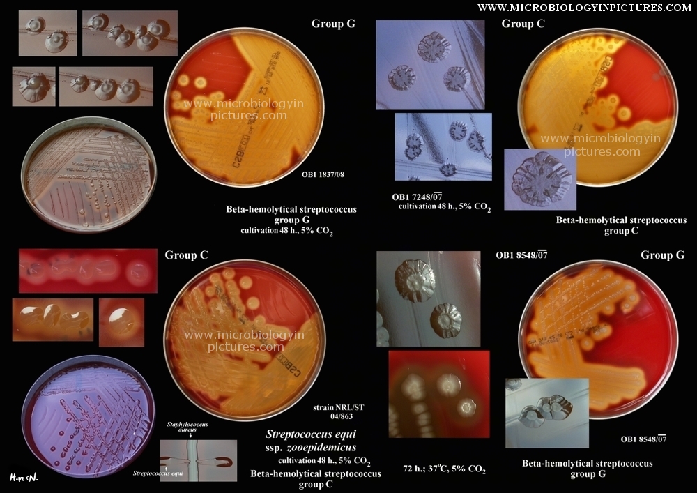 Beta-hemolytical streptococci on blood agar