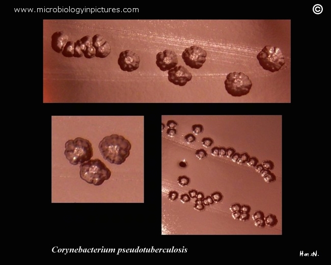 corynebacterium xerosis colony morphology