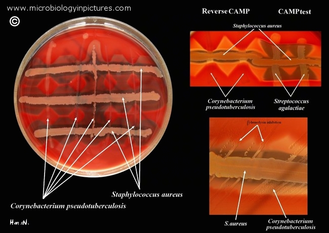 The Reverse CAMP test with Corynebacterium pseudotuberculosis and  Staphylococcus aureus on blood agar.