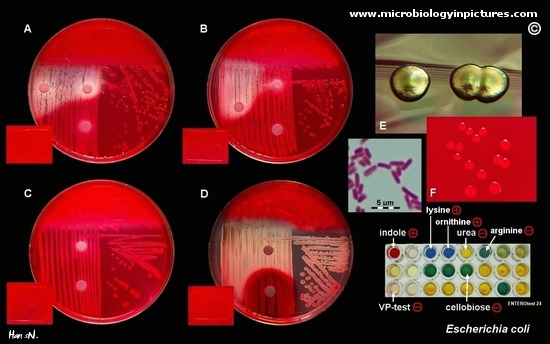 Escherichia Coli Colony Morphology And Microscopic Appearance Basic Characteristic And Tests For Identification Of E Coli Bacteria Images Of Escherichia Coli Antibiotic Treatment Of E Coli Infections