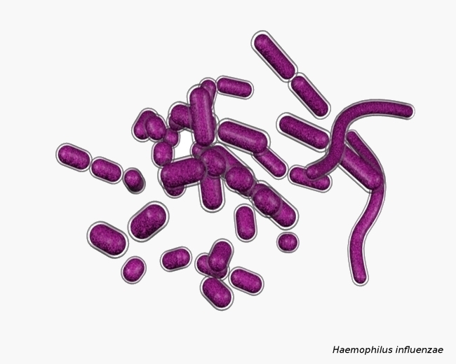 Haemophilus в мазке у мужчин