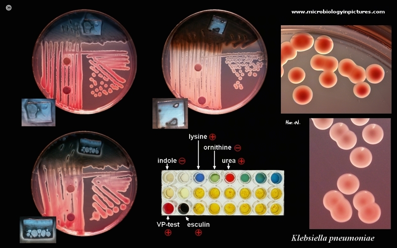 Bacterial Colony Characteristics Chart