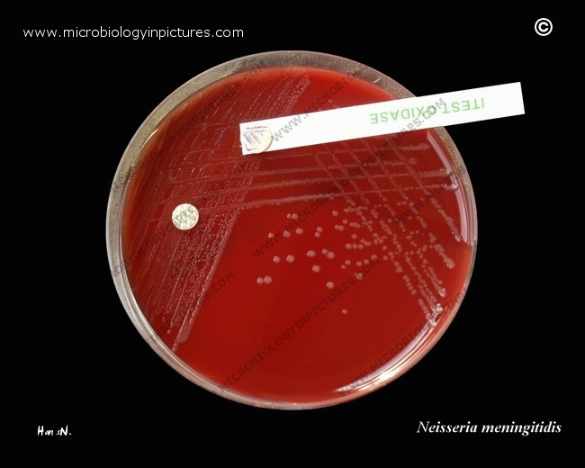 n meningitidis
