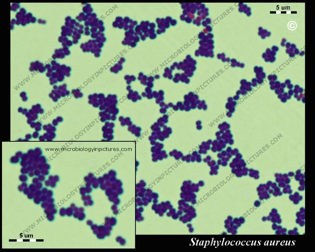 Eisco Prepared Microscope Slide - Staphylococcus Aureus Gram Positive  Microbiology