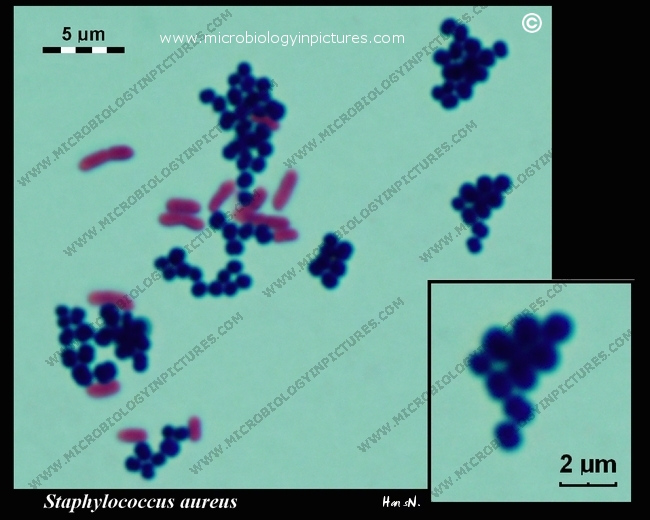 Staphylococcus epidermidis 400x, A slide of gram-stained St…