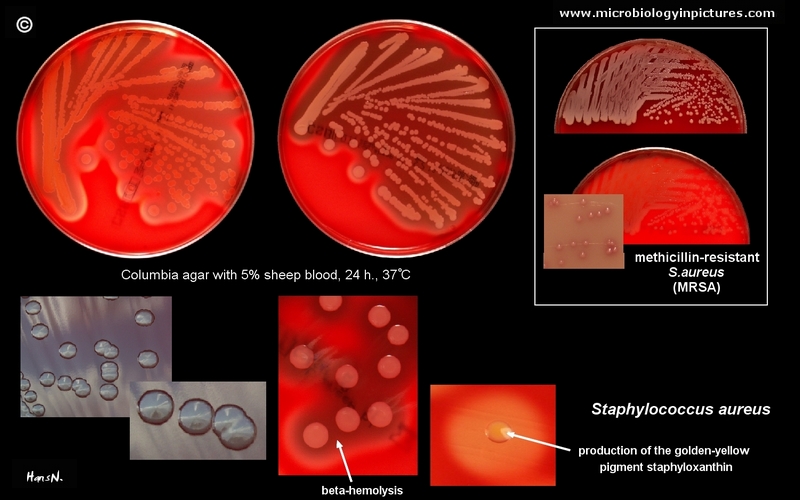 Staphylococcus epidermidis - microbewiki