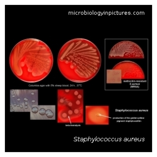 Microorganisms, Free Full-Text