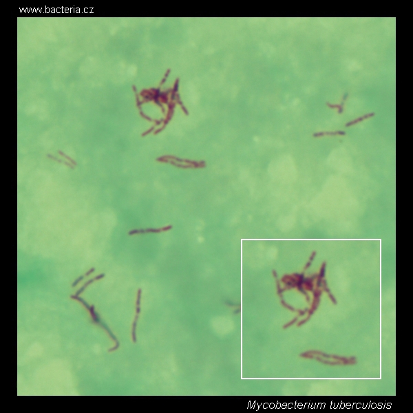 mycobacterium tuberculosis morphology under the microscope