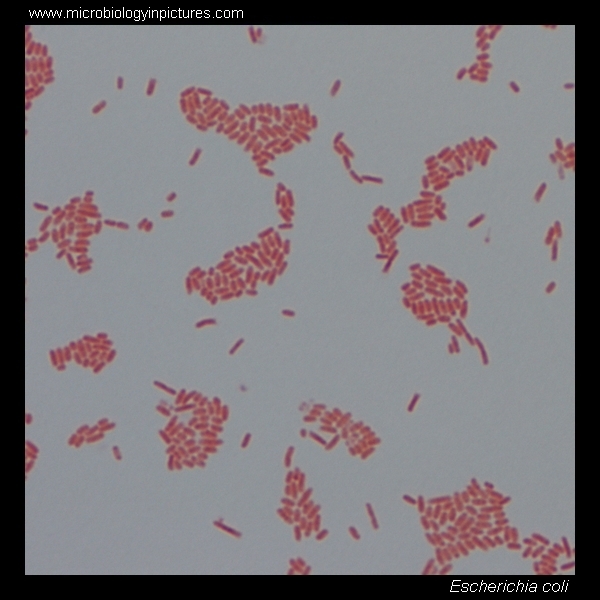 E Coli Gram Stain And Cell Morphology E Coli Micrograph Appearance Under The Microscope E Coli Cell Morphology E Coli Microscopic Picture