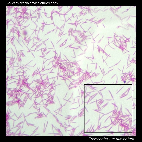 fusobacterium nucleatum morphology under microscope