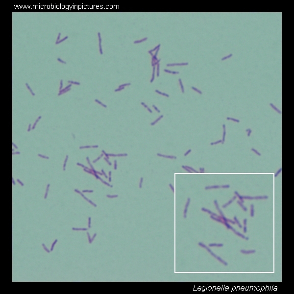 legionella pneumophila morphology under microscope