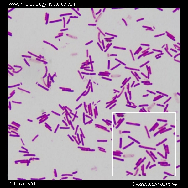 C.difficile micrograph, Gram-stain