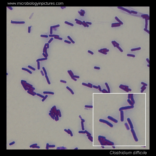 clostridium difficile micrograph