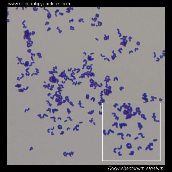 corynebacterium micrograph, diphtheroids