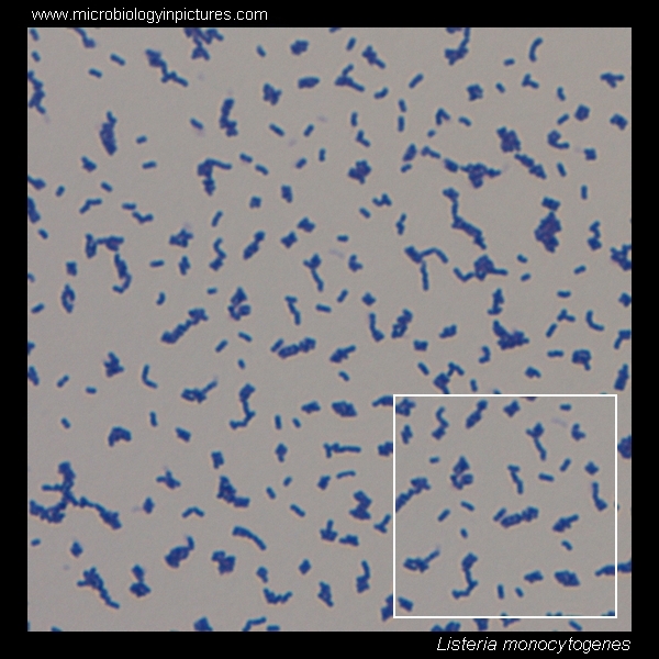 listeria morphology under the microscope