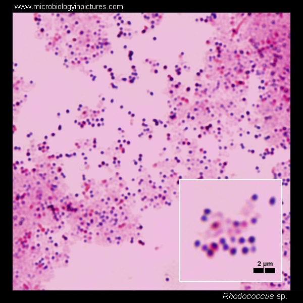 rhodococcus micrograph