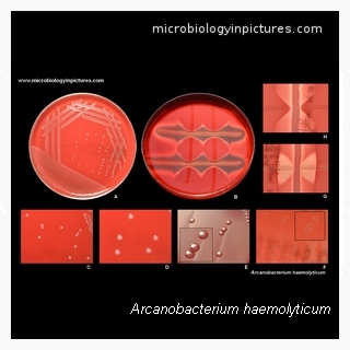 arcanobacterium