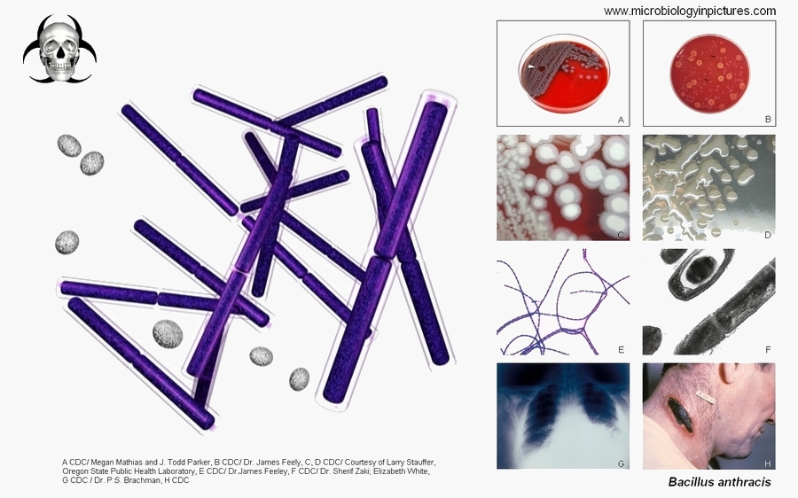 Bacillus anthracis images