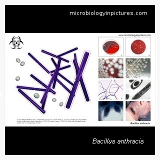 bacillus anthracis