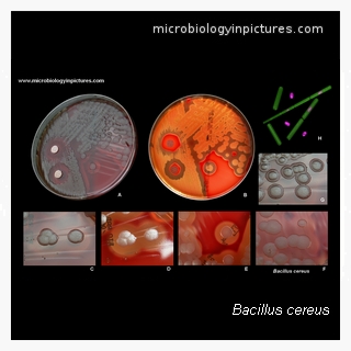 bacillus cereus