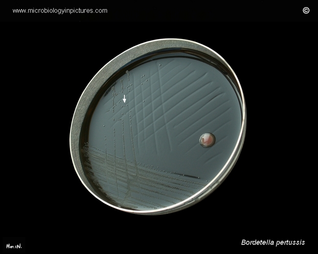 bordetella pertussis on agar with horse blood