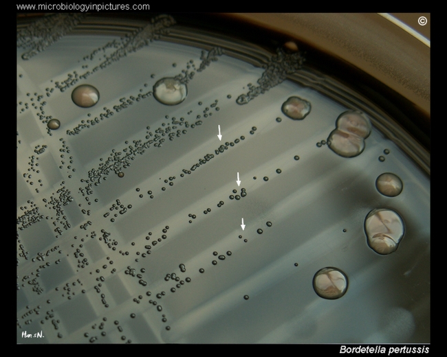 bordetella pertussis colonies on agar with horse blood