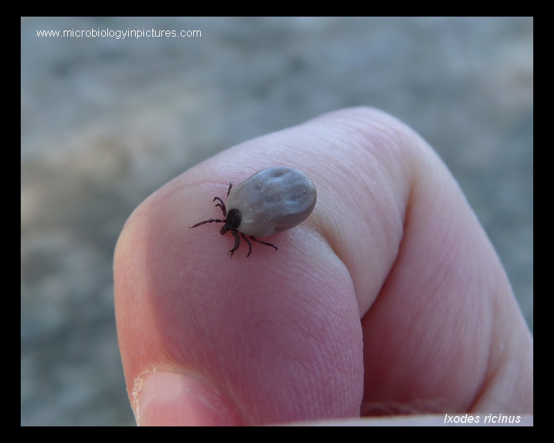 Ixodes ricinus I.ricinus tick