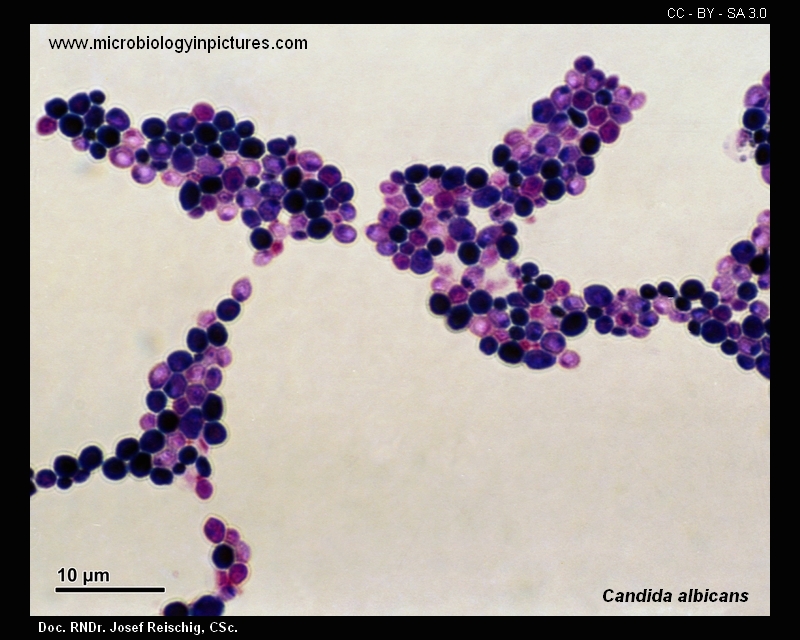 c.albicans Gram staining technique