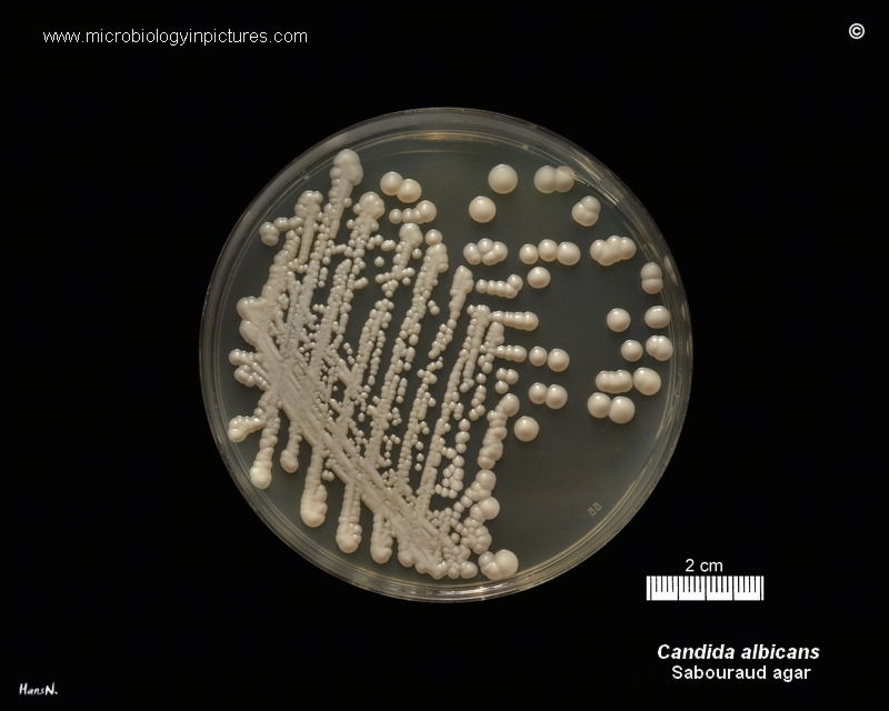 Candida albicans culture in Petri dish C.albicans pure culture in Petri dish