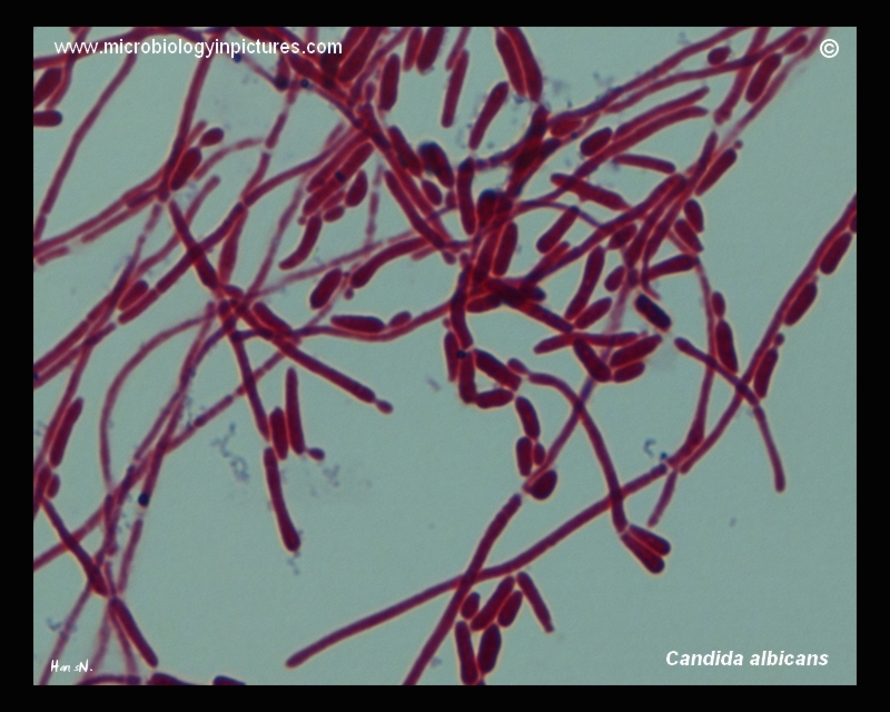 Candida albicans filamentous stage of development. Pseudohyp