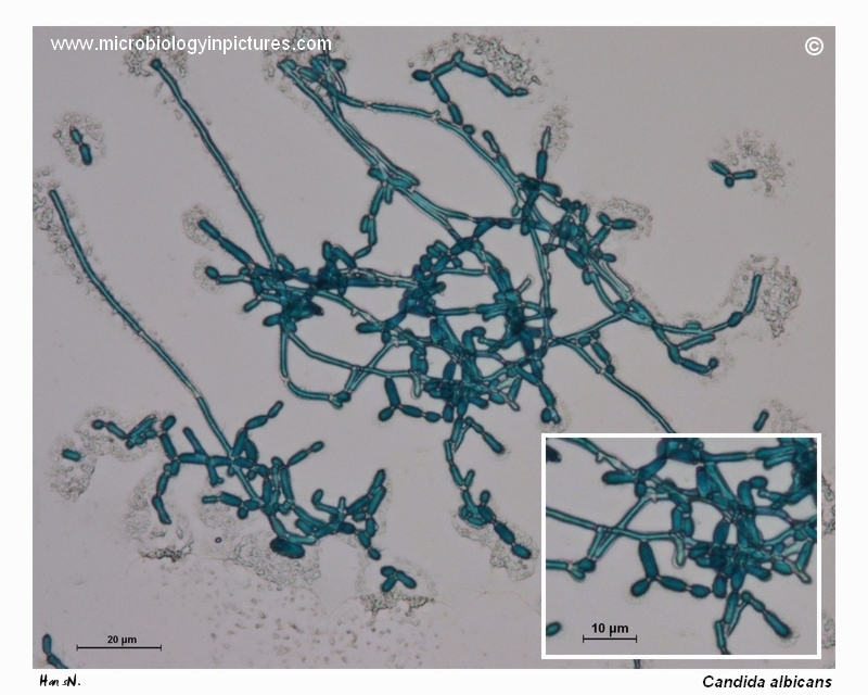 C.albicans hyphae and pseudohyphae formation hyphae and pseudohyphae