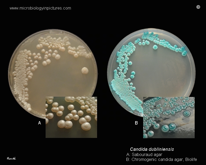 Colony morphology and appearance of Candida dubliniensis on 