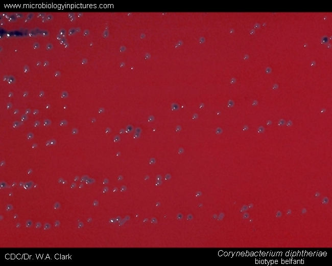 c.diphtheriae biotype belfanti, colony morphology