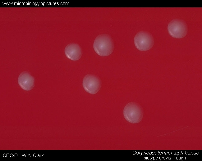 corynebacterium xerosis colony morphology