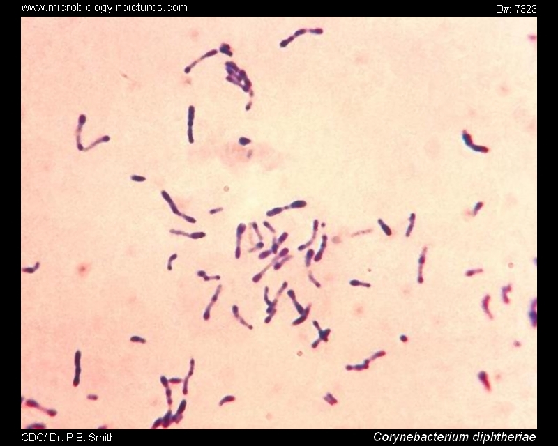 corynebacterium diphtheriae,  microscopic appearance, methylene blue stain