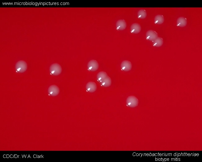 c.diphtheriae biotype mitis, colony morphology