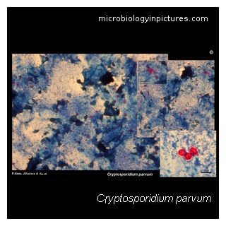 cryptosporidium
