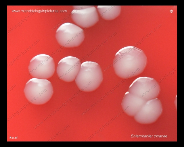 Enterobacter cloacae colony morphology on blood agar