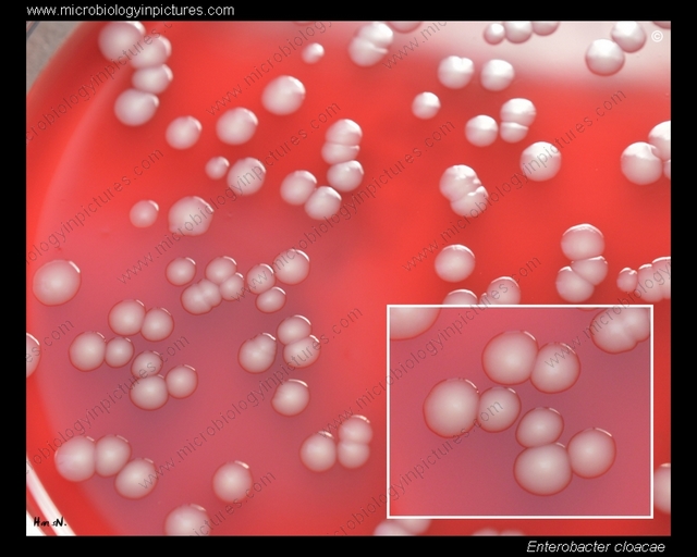 culture of Enterobacter cloacae on blood agar