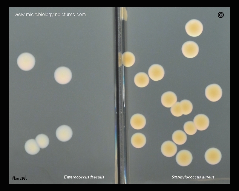 Colonies of E.faecalis and S.aueus on tryptic soy agar colonies of enterococci and staphylococci on tryptic soy agar