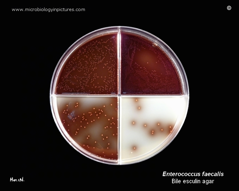 Enterococcus colonies growing on bile esculin agar, colonies with esculin hydrolysis