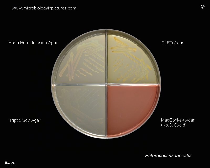 Colonies of E.faecalis on CLED, MacConkey No.3, TSA and BHI agar comparison of E.faecalis growth on various cultivation media
