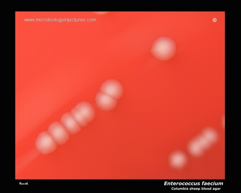 Enterococcus faecium on blood agar Enterococcus faecium colonies growing on sheep blood agar