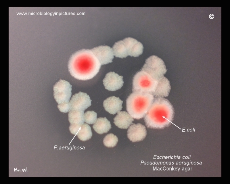 Escherichia coli что это у мужчин. E. coli на агар МАККОНКИ. E. coli, рост колоний на агаре масconkey. Pseudomonas aeruginosa агар МАККОНКИ. Escherichia coli гемолитическая.