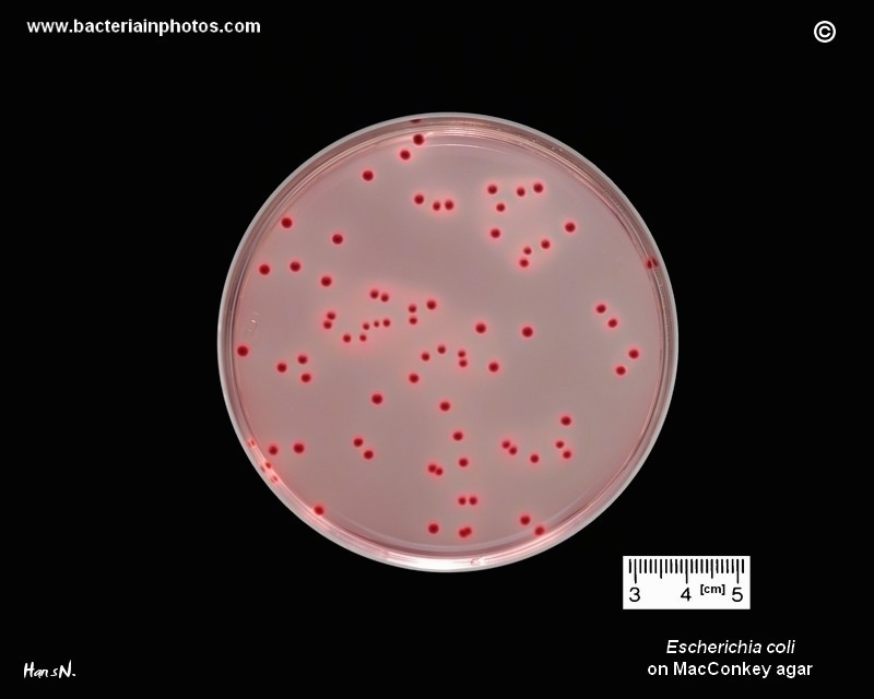 E.coli on agar
