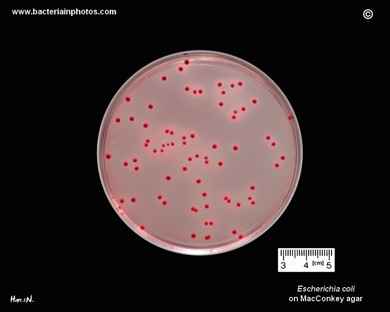 E Coli On Macconkey Appearance And Growth Characteristics On Escherichia Coli On Macconkey Agar