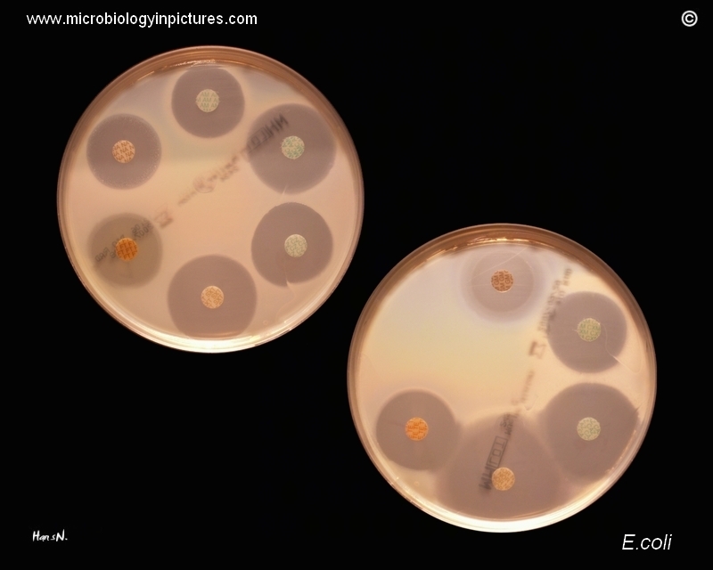 Antibiotic susceptible  tested with disc diffusion test on Mueller  Hinon agar.